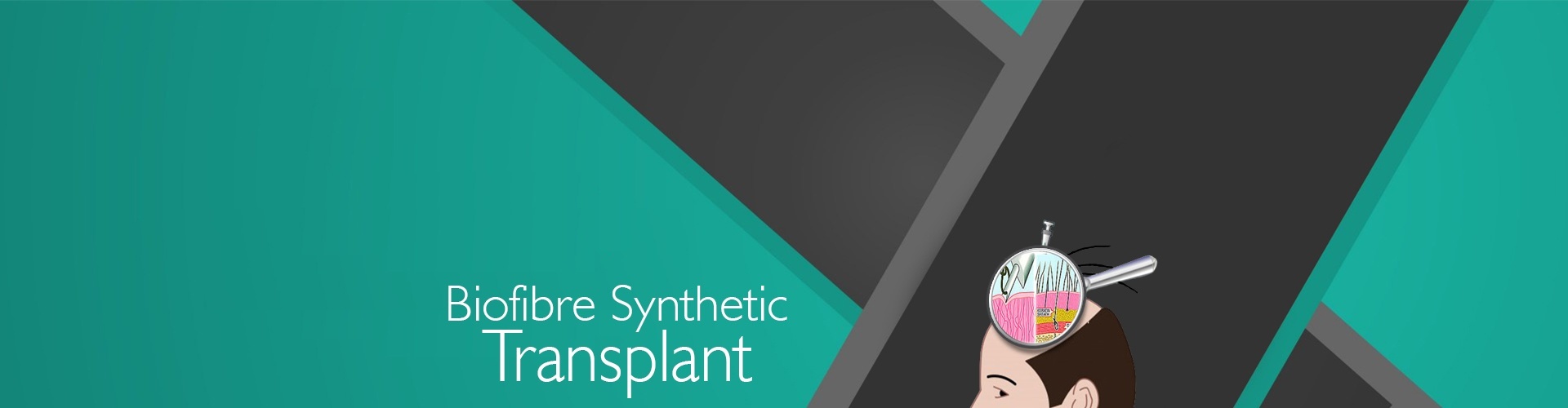 Biofibre Synthetic Hair Implant in Pune - Cost, Results