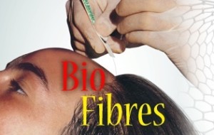 Biofibre Synthetic Hair Implant in Pune - Nido Artificial Hair Transplant Cost, Results | Dezire Clinic Pune