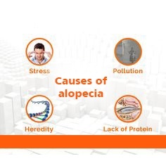 Alopecia treatment Pune