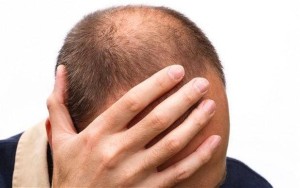 Best Hair Loss Treatment for Men in Pune – Baldness Cure, Hair Loss Cure for Male in Pune With 100% Results | Dezire Clinic Pune