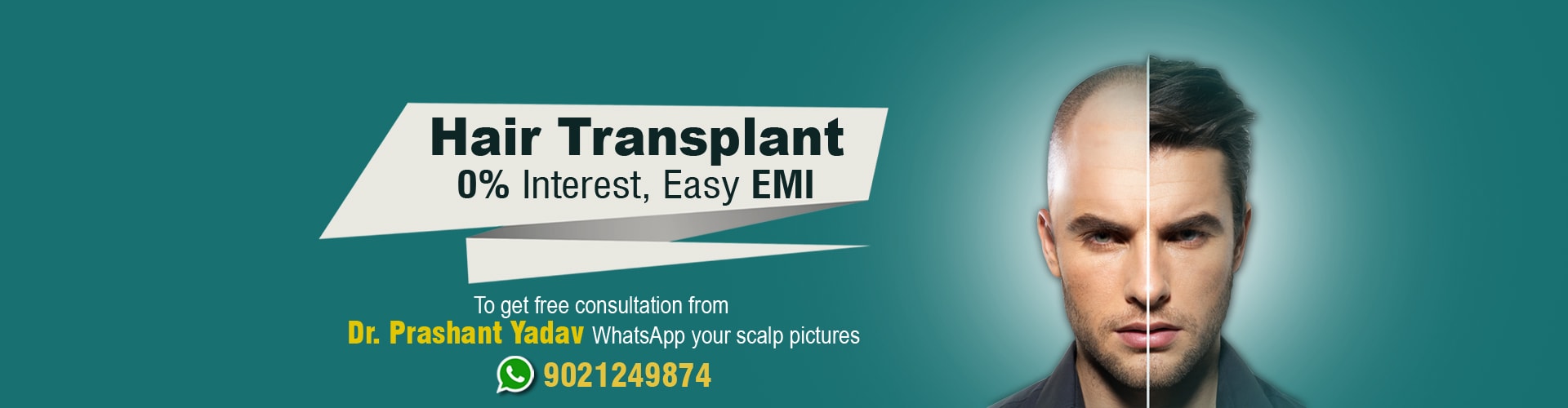 Hair Transplant Cost In Pune – Hair Transplant Pune