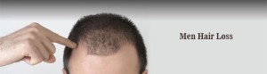 Latest In Hair Loss Treatment done at Dezire Clinic Pune