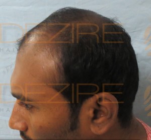 Hair Restoration Physician