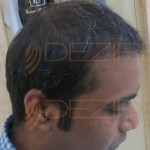 ayurvedic medicines for hair fall
