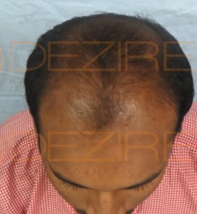 female hair loss doctor