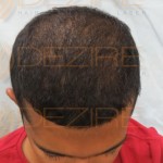 hair reconstructor treatment