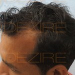non surgical hair replacement disadvantages