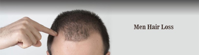 Men hair loss