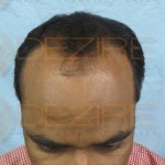 repair severely chemically damaged hair
